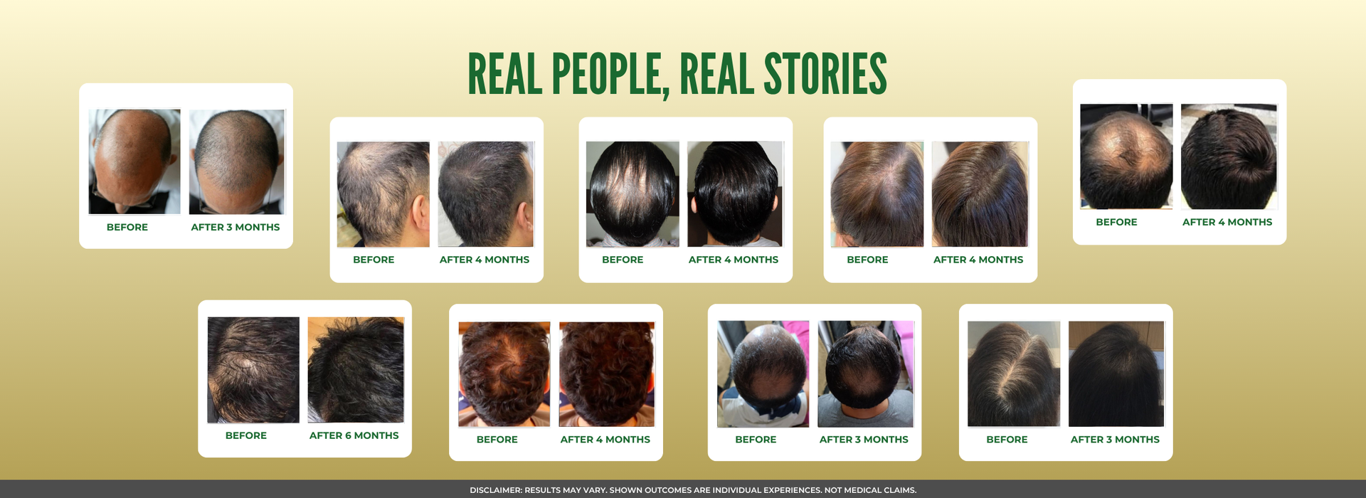 Ayurvedic Hair Vital Oil for Hair Fall & Hair Growth