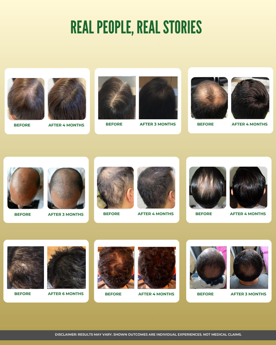 Ayurvedic Hair Vital Oil for Hair Fall & Hair Growth