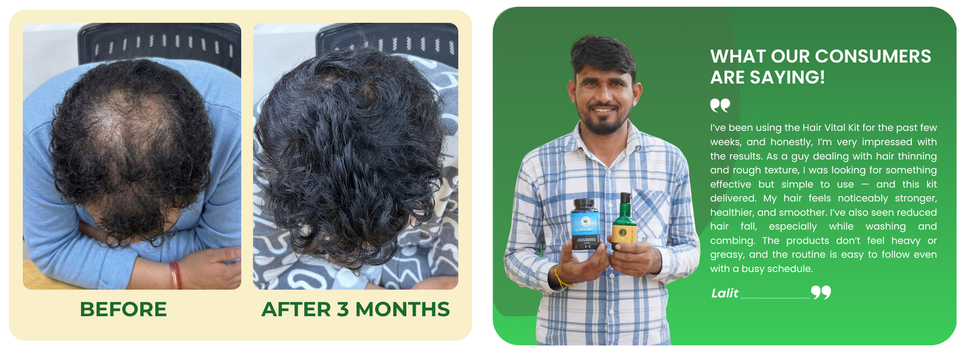 Hair Fall Treatment Kit Ayurvedic - Hair Vital Kit for Regrowth