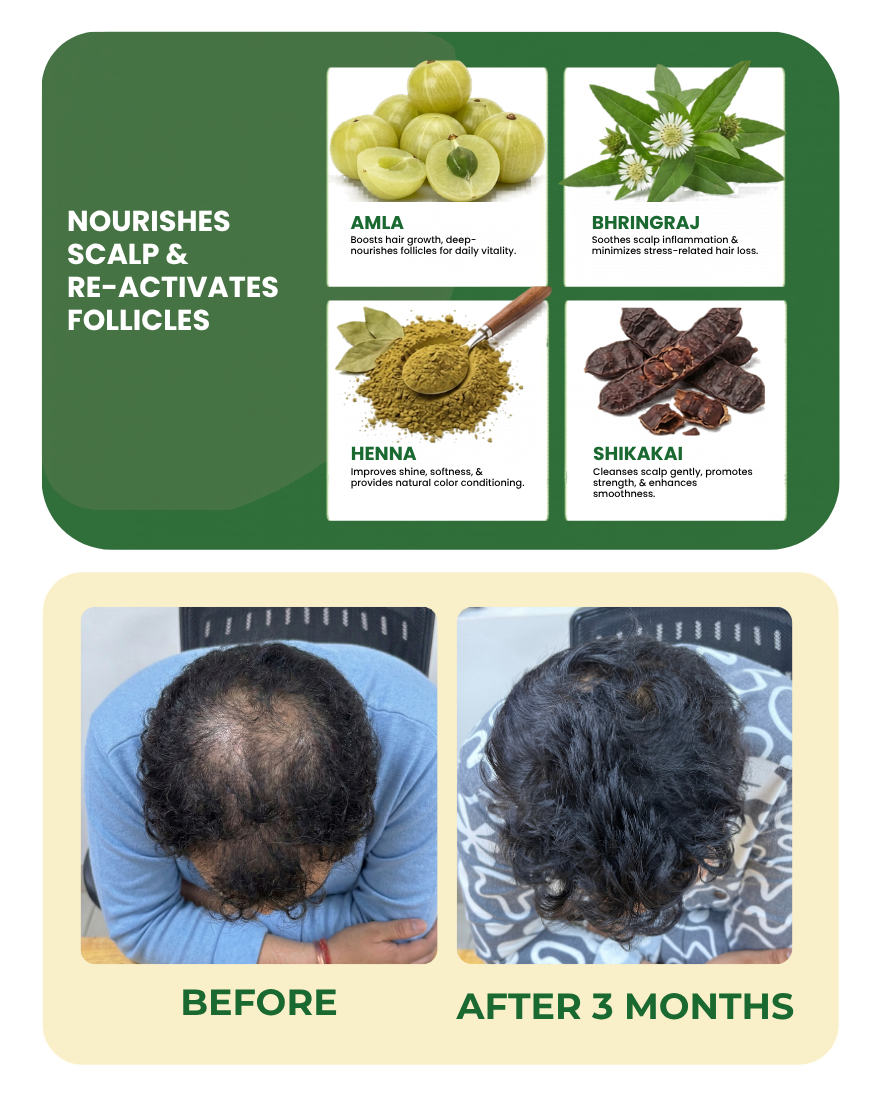 Ayurvedic Hair Vital Oil for Hair Fall & Hair Growth