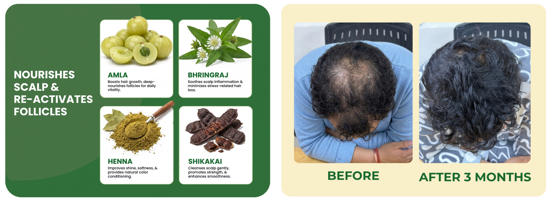 Ayurvedic Hair Vital Oil for Hair Fall & Hair Growth