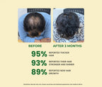 Before and after comparison of hair growth treatment with statistics on improved hair health.
