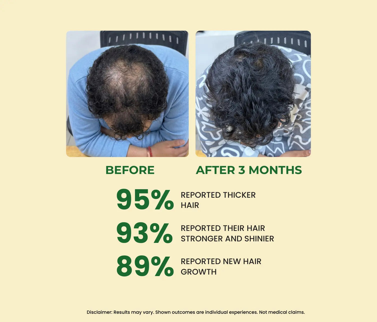Before and after comparison of hair growth treatment with statistics on improved hair health.