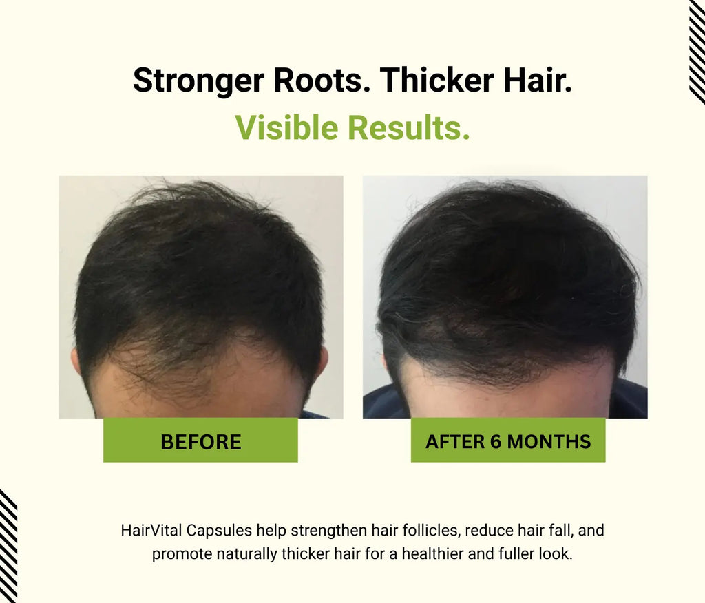 Before and after comparison of hair growth with 'Stronger Roots. Thicker Hair.' text and 'Visible Results.' label.