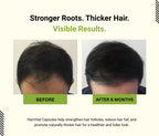 Before and after comparison of hair growth with 'Stronger Roots. Thicker Hair.' text and 'Visible Results.' label.